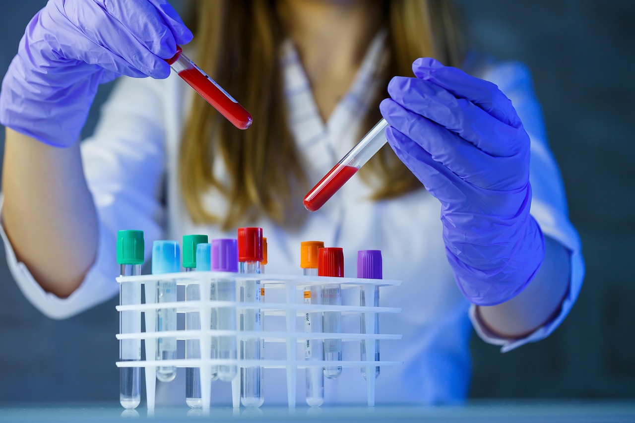 Manos con guantes sostienen dos tubos de sangre sobre una gradilla de laboratorio, base del análisis de anticuerpos de la celiaquía
